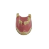 anatomical dental implant training models