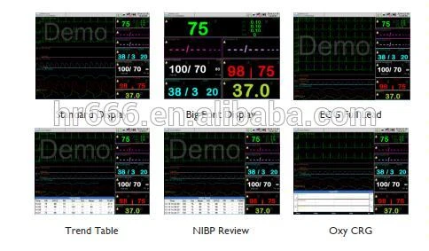 China good price medical multi-parameter patient monitor price for hospitals operation room