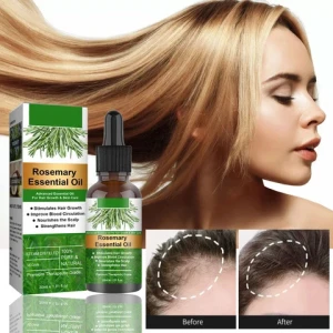 OEM/ODM Hair care Rosemary Oil Black Women And Men Hair care Oil Hair Care Oil