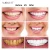 Wholesale Private Label  Teeth Whitening Oral Gel Kits remove stains teeth whitening light and teeth whitening pen