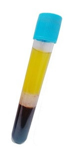 22ml platelet rich plasma prp tube