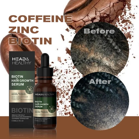 Buy Hair Growth Oil Treatment from Shihuanuo (guangdong) Biotechnology