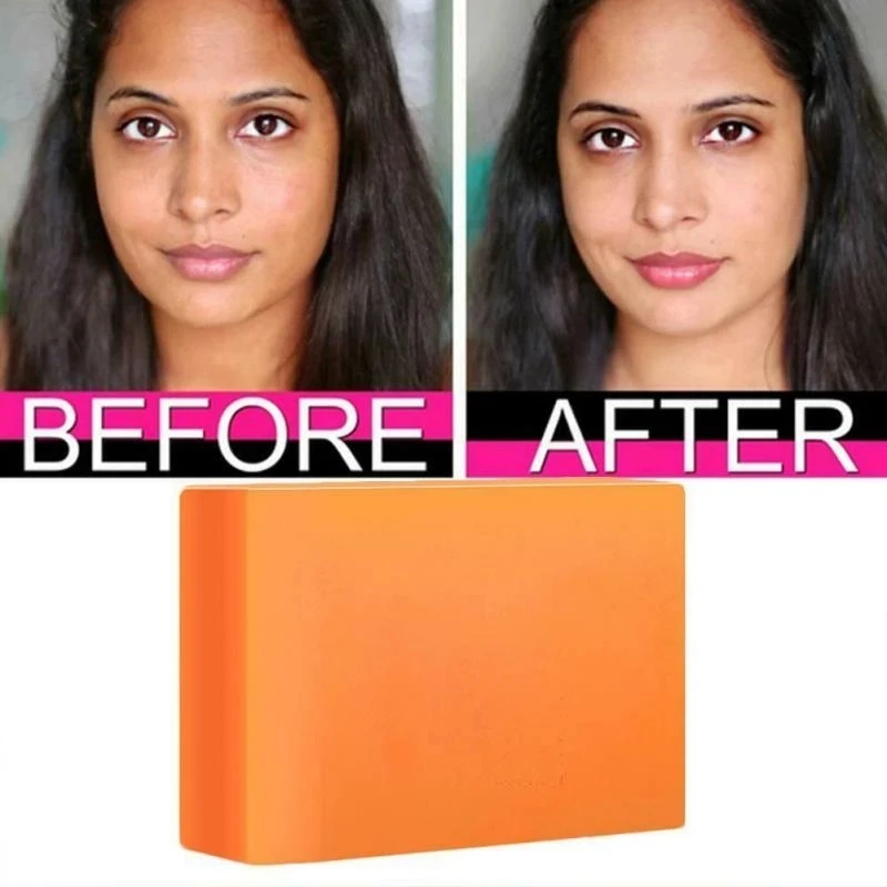 100g Handmade Organic Kojic Soap Skin Lightening Bleaching Anti-Acne 100% Kojic Acid Whitening Soap