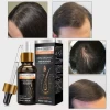 OEM DHT Blockers Vitamins Hair Growth Serum Natural Hair Regrowth Oil Private Label Hair Oil Organic Saw Palmetto Oil Serum