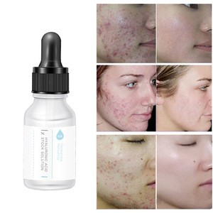 private label organic 100% pure hyaluronic acid essence anti-aging wrinkle dark spots face serum with hyaluronic acid