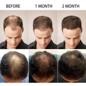 Private Label 100% Pure Natural Organic Hair Care Loss Treatment Serum Anti Hair Loss Anti Frizz Hair Growth Essential Oil