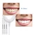 Import Private Logo Dental Bleaching Led Light Lamp Tooth Whitener Pen Kits Teeth Whitening Machine Blanchiment Dentaire Teeth Care from China