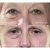 Import Ami Eyes Stimulator Anti-Wrinkle Lumi Eyes Dark Circle Eye Valley Tears Stimulates Hdna More Collagen Elastin Polynucle from China