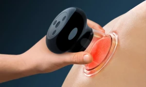 Electric Cupping Massager