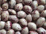 hot sale light speckled kidney bean