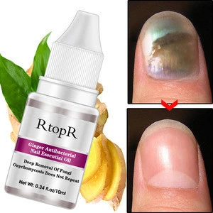 Private label fungal nail treatment essential Oil antibacter nail nutrition cuticle oil