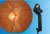 Import Retinal Viewing System Fundus Viewer for Slit Lamp Digital Fundus Imaging Solution from China