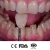 Import High Strength Dental zircon disks / dental zirconia blanks for open system from China
