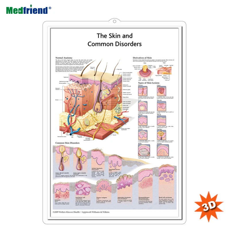 Licensed Educational Plastic 3D Medical Anatomical Wall Chart /Poster  - The Skin and Common Disorders