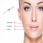 1ml 2ml hyaluronic acid filer ha dermal filler with high quality sodium injection