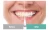 2020 New Arrival EU Standard Colorful Non Peroxide Teeth Whitening Gel Pen