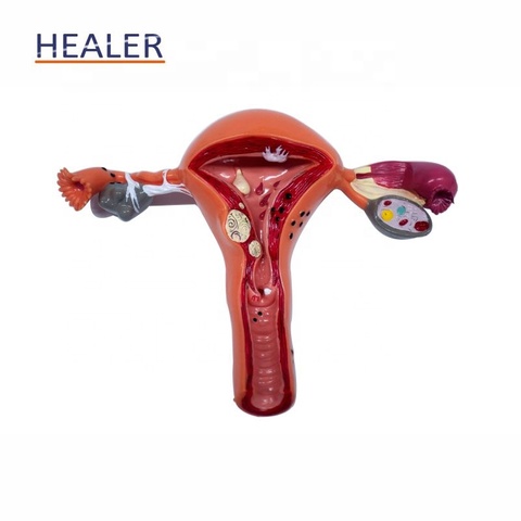 Anatomic model of female reproductive organ uterus vagina, female womb model