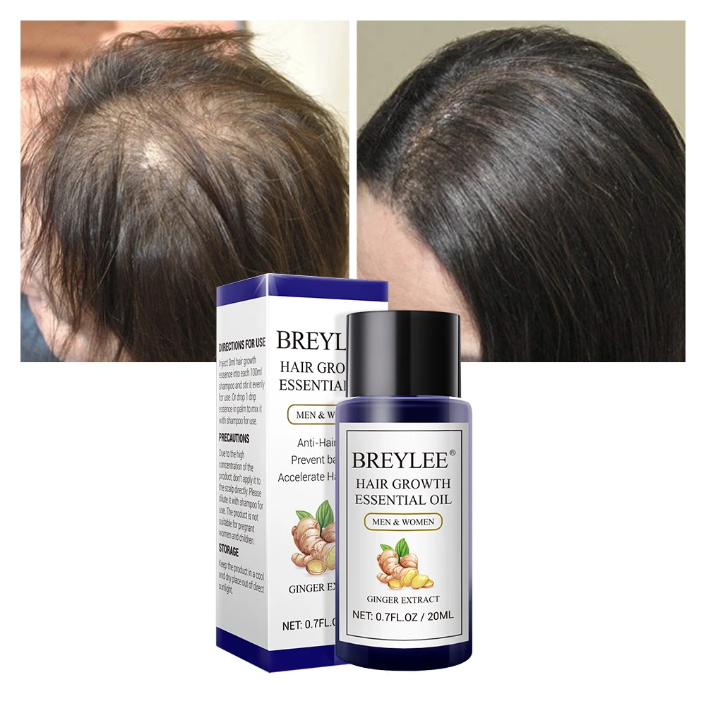 BREYLEE China hair growth natural extract oil for hair