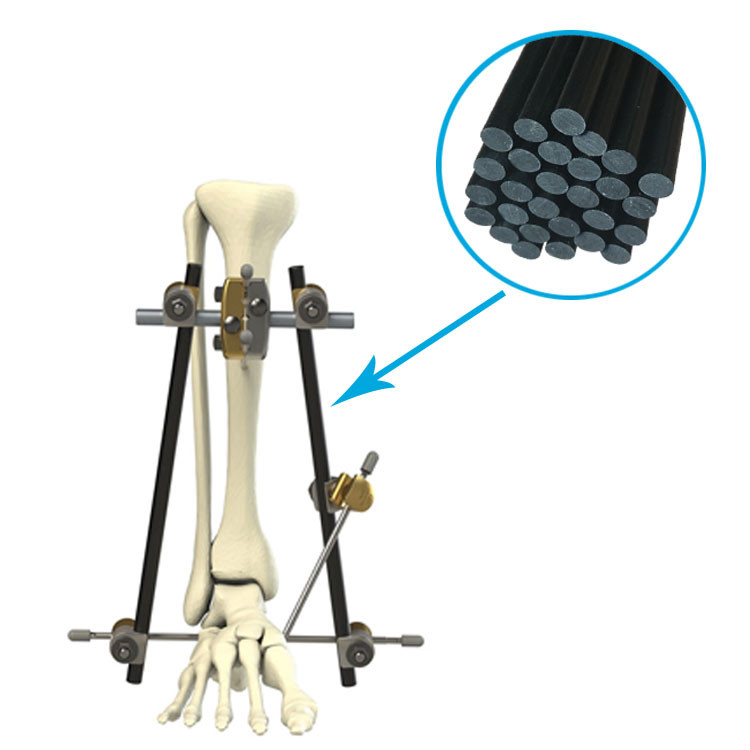 Buy Large Bone Temporary External Fixation System 5mm 8mm 11mm 12mm ...