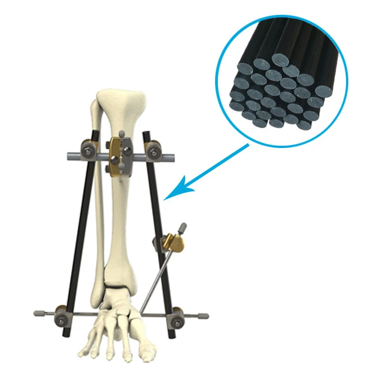 Large Bone Temporary External Fixation System 5mm 8mm 11mm 12mm carbon fiber rods