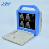 Manufacture price LCD laptop portable ultrasound machine
