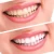 Import Teeth Whitening Dry Strips Need 3D Whitestrips , High Quality Teeth White Dry Strips from China