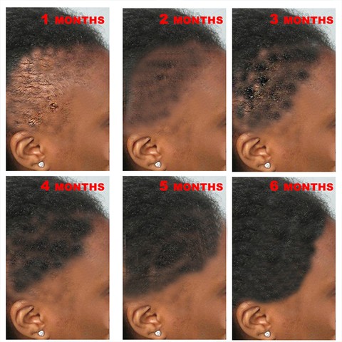 Custom Packaging loss treatment hair growth oil serum woman man hair anti loss mild hair regrowth ginger serum oil