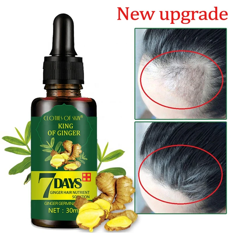Hair Care Grow Ginger Germinal Oil Hair Growth Essential Oil Hair Loss Treatment For Men Women 30ml