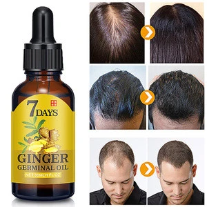 New 30ml 7 day Fast Hair Growth Essential Oil Effective Hair Loss Treatment Regrowth Ginger Serum Hair Health Care Beauty natura