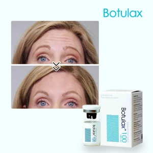 Wholesale Botulax 100iu 200iu 300iu Meditoxin Nabota Neuronox Innotox Botulinum Toxin Type A for Wrinkle Removal