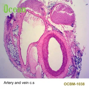 Artery and vein c.s  prepared microscope slides