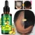 Import Effective Hair Loss Treatment Ginger Germinal Wild Hair Growth Essential Oil For Men and Women from China