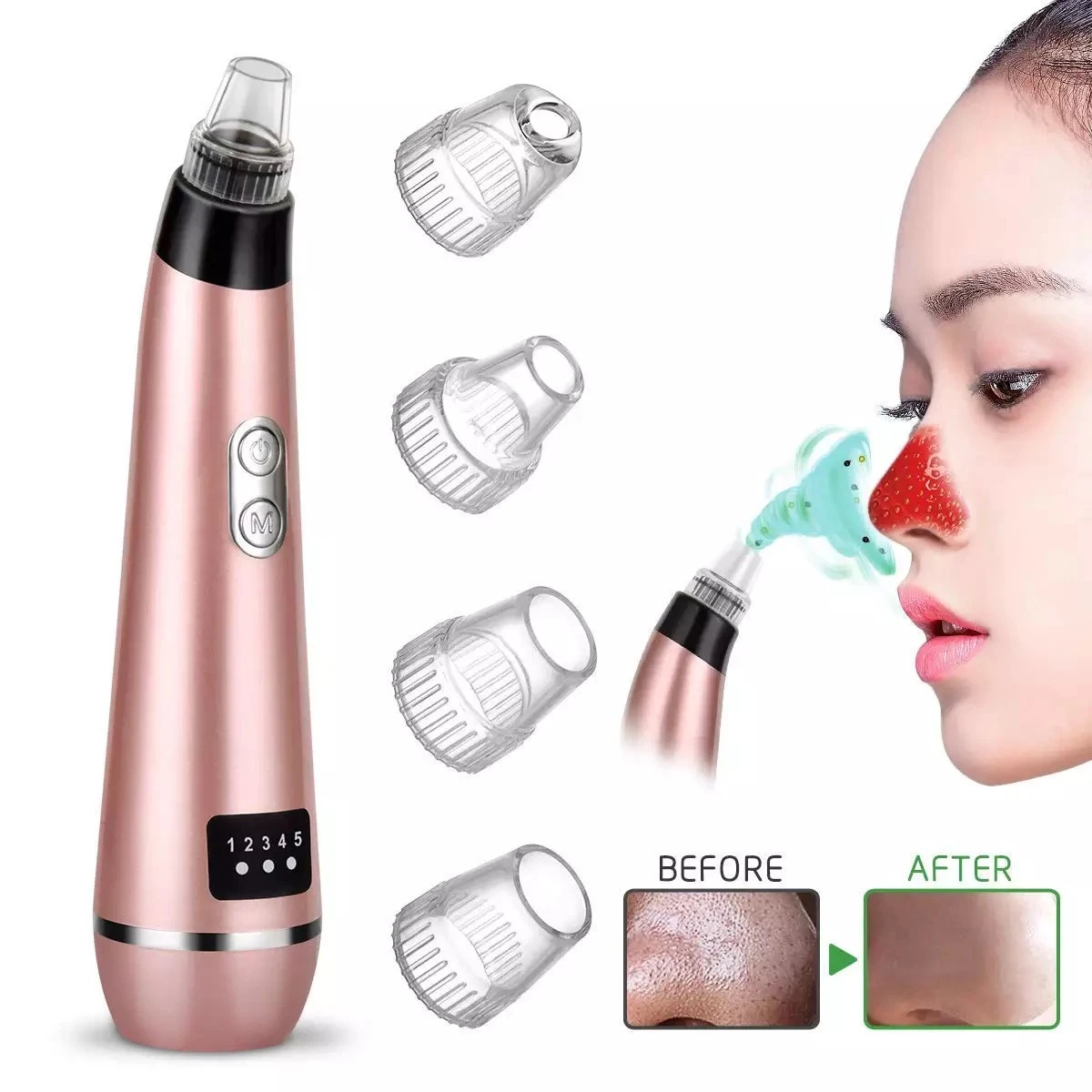 FDA 2019 New Arrivals  Best Selling Beauty Device Products Facial Pore Cleaner Blackhead Remover Suction Vacuum