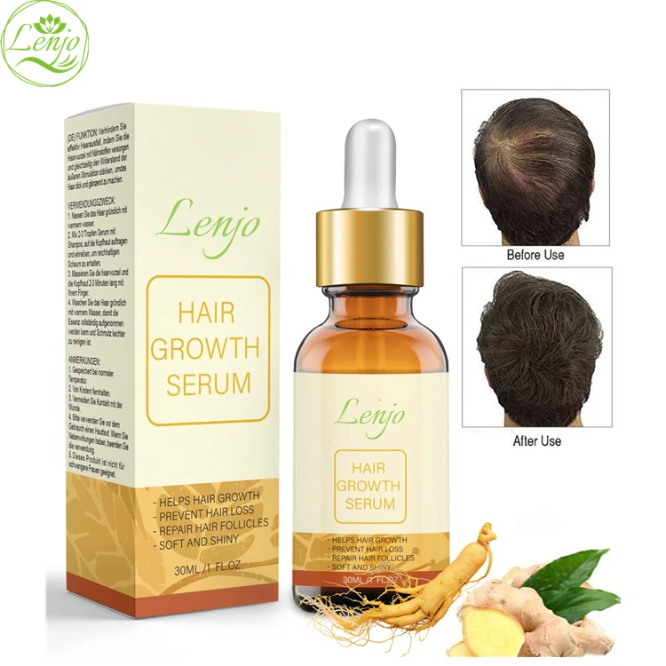 Private Label Hair Loss and Hair Thinning Treatment Ginseng Old Ginger Extract 30ml Hair Growth Serum