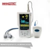 Medical equipment Capnoxi  monitor with CO2 sensor