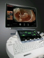 Used GE Voluson E10 Ultrasound Machine(BT16)+ RAB6-D(4D Convex)