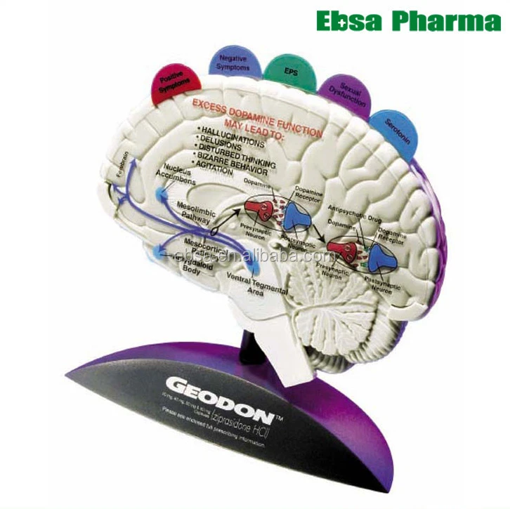 Advanced Medical Supplies Human Teaching Brain Model with Tabbed Overlays