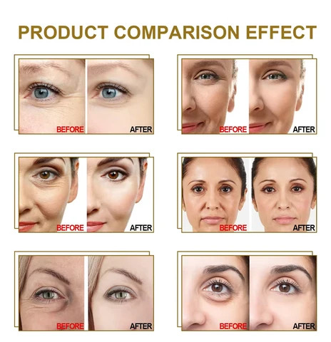 OVILZ 24K Gold Serum Facial Rejuvenation Skin Care Organic Retinol Hyaluronic acid Whitening Anti Wrinkle Serum