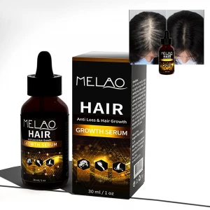 Private Label Herbal Anti Hair Loss Boosting Fast Hair Growth Serum