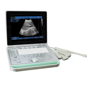 Portable Ultrasound Scan Machine