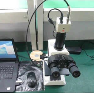 Semen microscope sperm analyzer software
