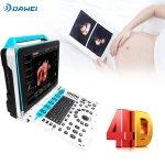 4D color ultrasound machine for OB/GYN