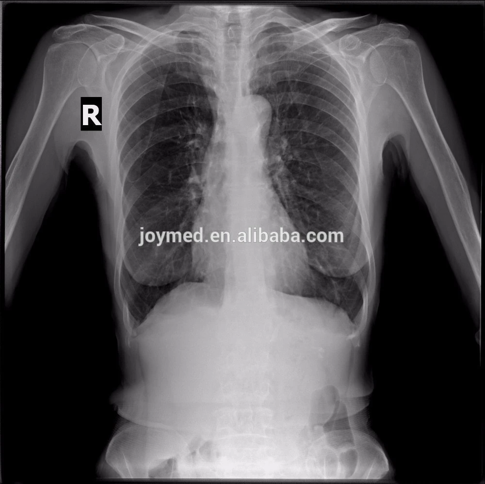 JM-640 digital mobile medical c-arm x-ray machine/Radiography Digital X-ray Medical Equipment