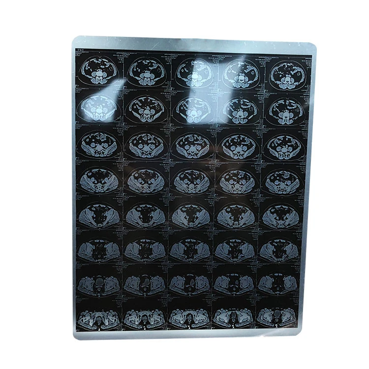 High Quality Hot Sale China Supply X Ray Machine Use Medical X-ray Film