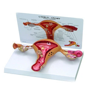 Medical teaching used human uterus pathology model