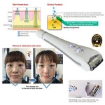 Pulse current radio wave facial tool beauty equipment for removing dullness