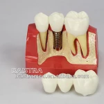 Worldwiade educational science models/dental care models
