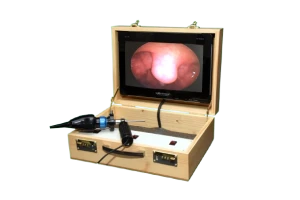 PORTABLE ENDOSCOPY UNIT