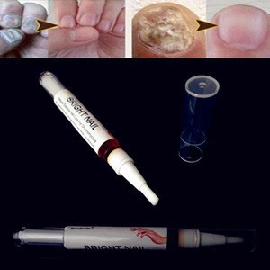 3ml Chinese Traditional Nail Onychomycosis Treatment care liquid pen dead nail remove soften foot feet care cure oil pen