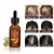 Import Aliver 30ML Natural Hair Loss Treatment Serum Hair Growth Essential Oil from China